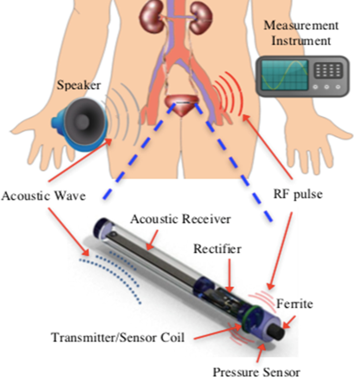 Implantable Sensors